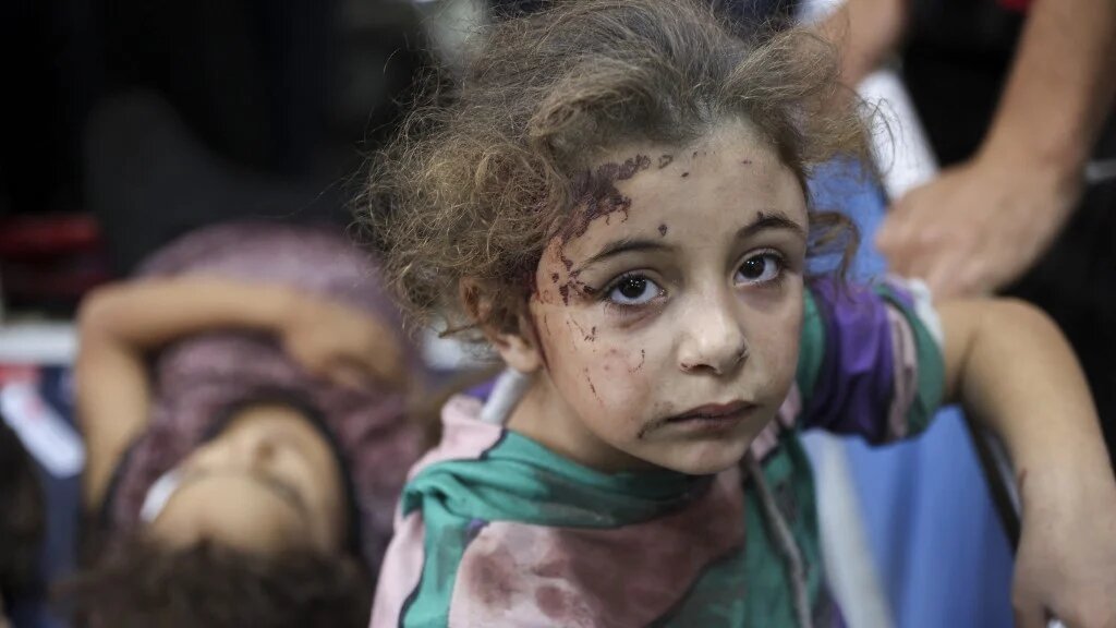 Children who were injured during an Israeli operation in the Jabalia refugee camp in the northern Gaza Strip await treatment at Al-Ahli Arab hospital, also known as the Baptist hospital in Gaza City on October 21, 2024 (AFP)