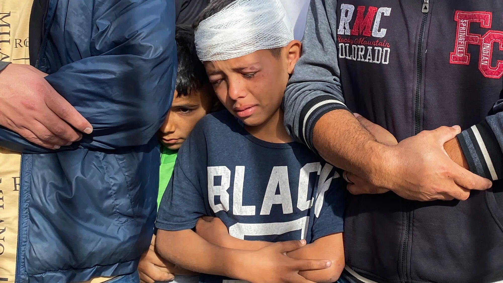A wounded Palestinian boy cries as he joins prayers for the people killed in Israeli strikes, outside the Nasser hospital in Khan Yunis in the southern Gaza Strip on 15 May 2025 (AFP)