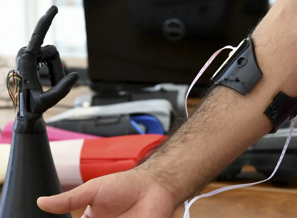 La main de Cure Bionics se compose d’éléments emboîtés, ce qui permet de remplacer facilement un élément endommagé (AFP)