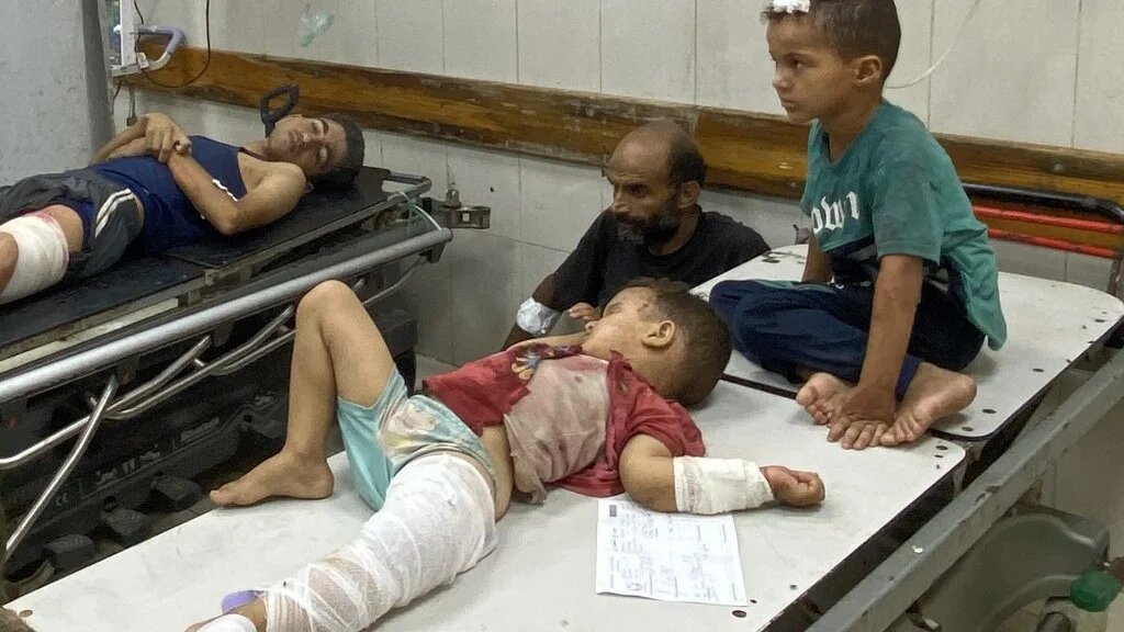 Injured children wait for treatment at Nasser Medical Complex in the southern Gaza Strip on 28 July 2025, following Israeli bombardment on the Mawasi area of Khan Yunis (AFP)