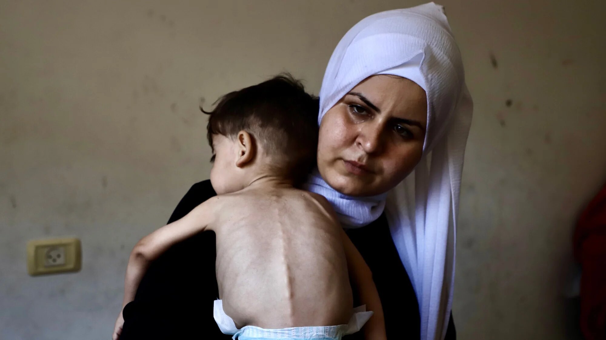 A Palestinian woman with her malnourished son in Gaza City (MEE/Mohammed al-Hajjar)