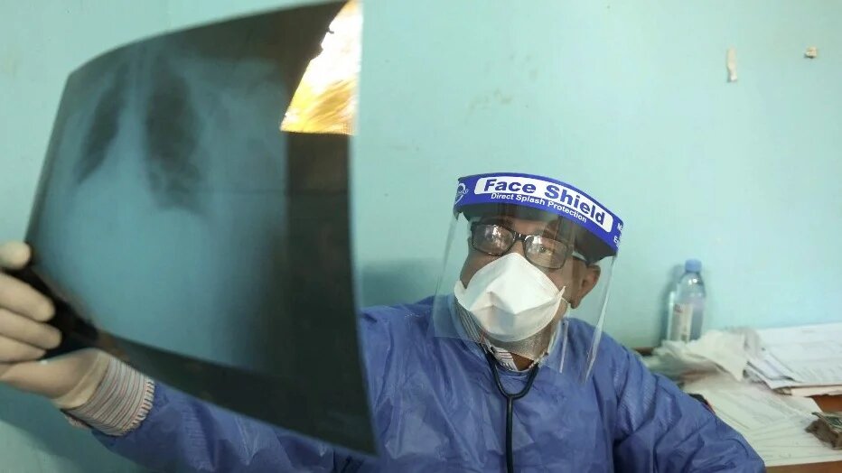 In this file photo, an Egyptian doctor checks a patient's lung X-ray at the infectious diseases unit of the Imbaba hospital in the capital Cairo, on 19 April 2020 (AFP)
