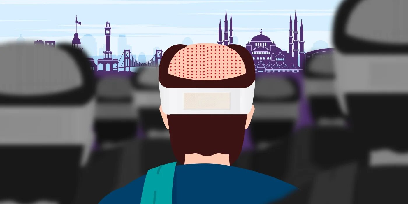 Patients are drawn to Turkey for procedures like hair transplants due to cheap prices and the speed of procedures (Illustration/MEE)