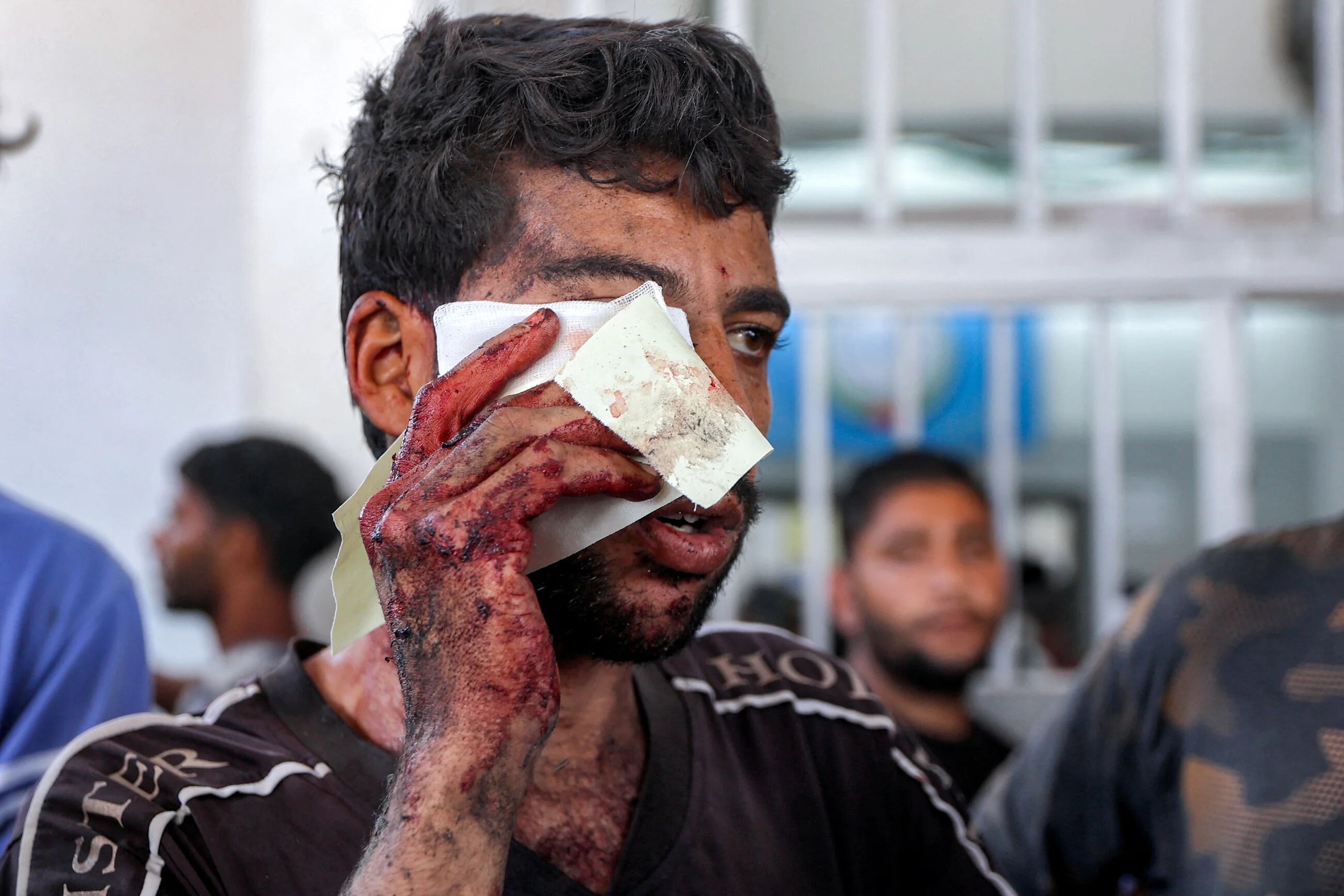 A wounded Palestinian man holds a bandage to his face following Israeli attacks on aid seekers in al-Sudaniya, an area in northwestern Gaza, on 14 June 2025 (AFP/Omar al-Qattaa)