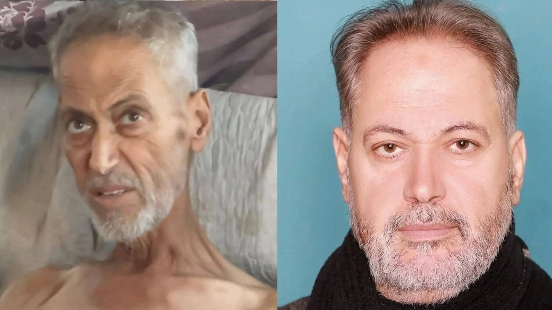 Renowned Palestinian academic Omar Harb pictured before (right) and after (left) Israel's months-long blockade on the besieged enclave, causing widespread famine across the territory (X)