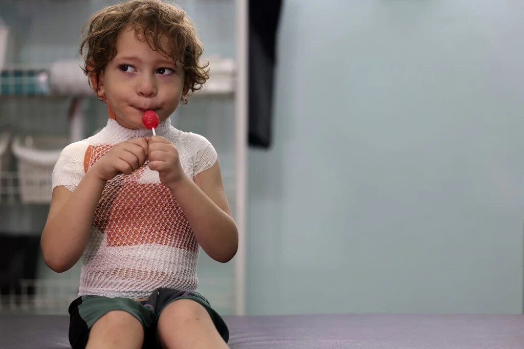 Yasser Khila, quatre ans, est réconforté avec une sucette après qu’un pansement a été appliqué sur ses brûlures, dans une clinique gérée par Médecins sans frontières (MSF) à Gaza le 7 septembre 2022 (AFP/Mohammed Abed)