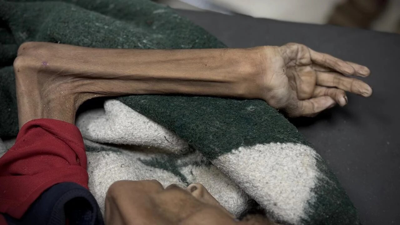 Raheel Rosros is one of four who succumbed to malnutrition on Tuesday (MEE/Ahmed Aziz)