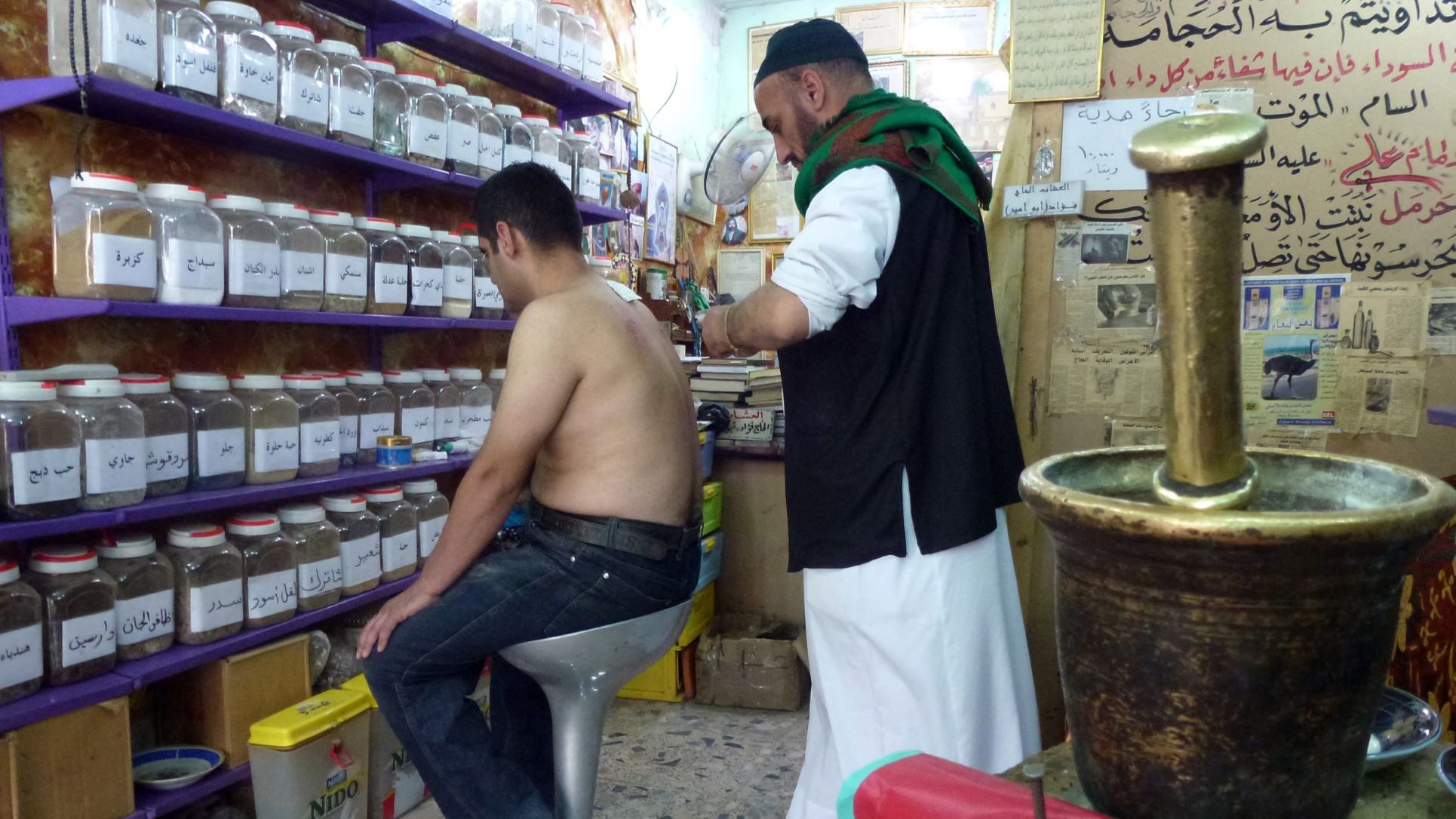 wet-cupping-iraq-afp