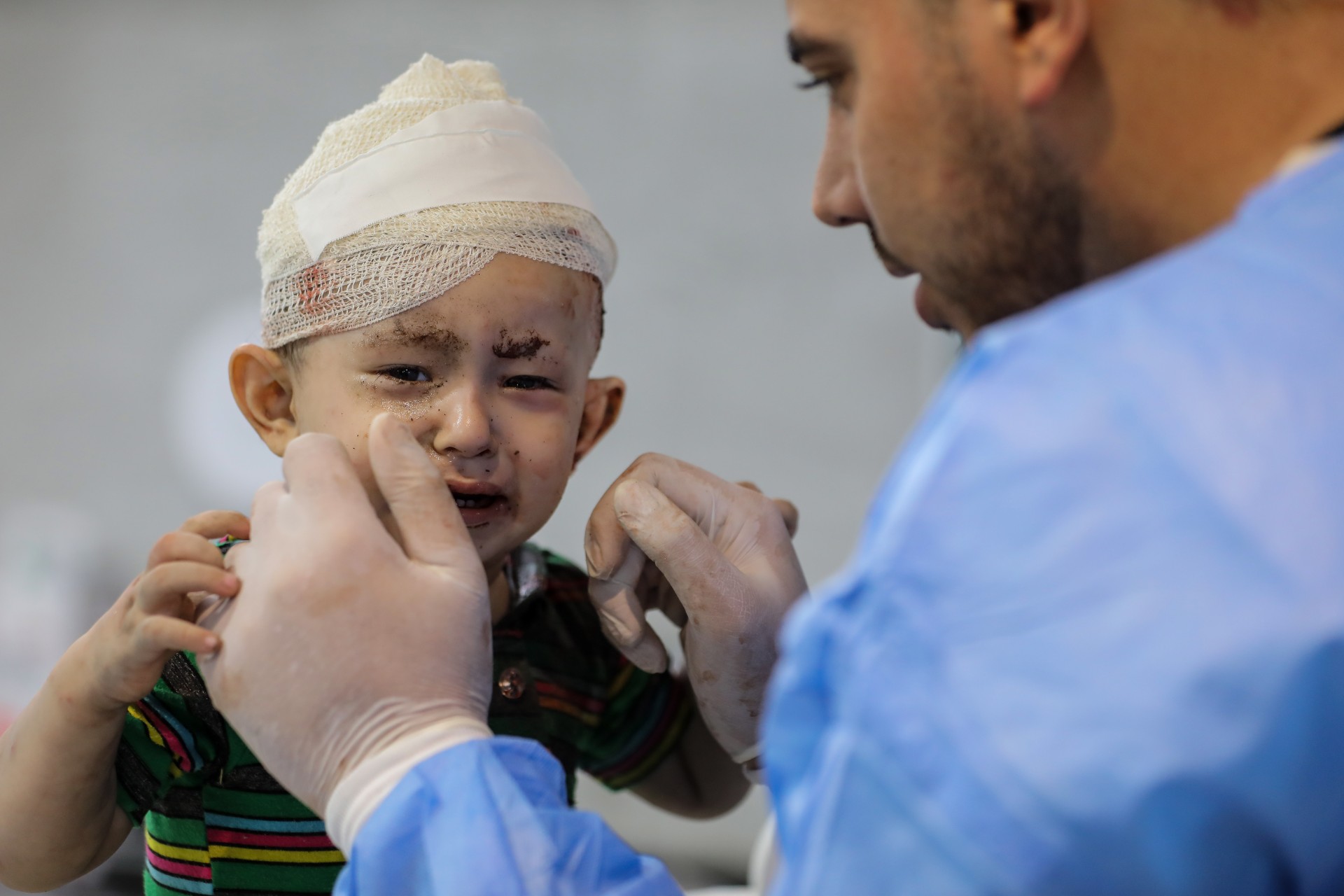 wounded child gaza al shifa hospital